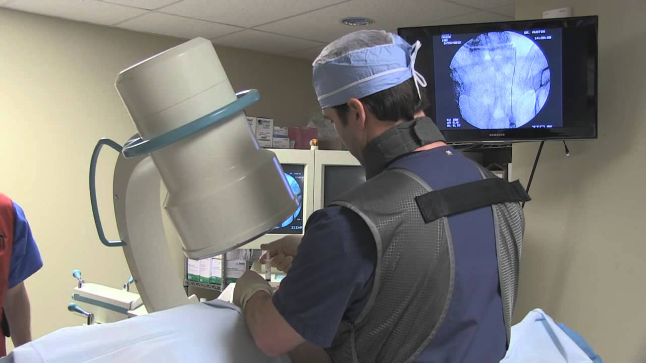 SIJ Radiofrequency Ablation