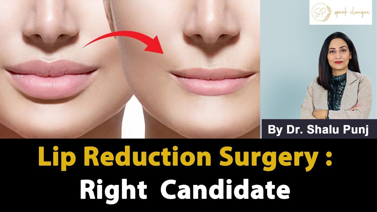 Lip 👄 Reduction Surgery | Dr. Shalu punj - Plastic Surgeon India