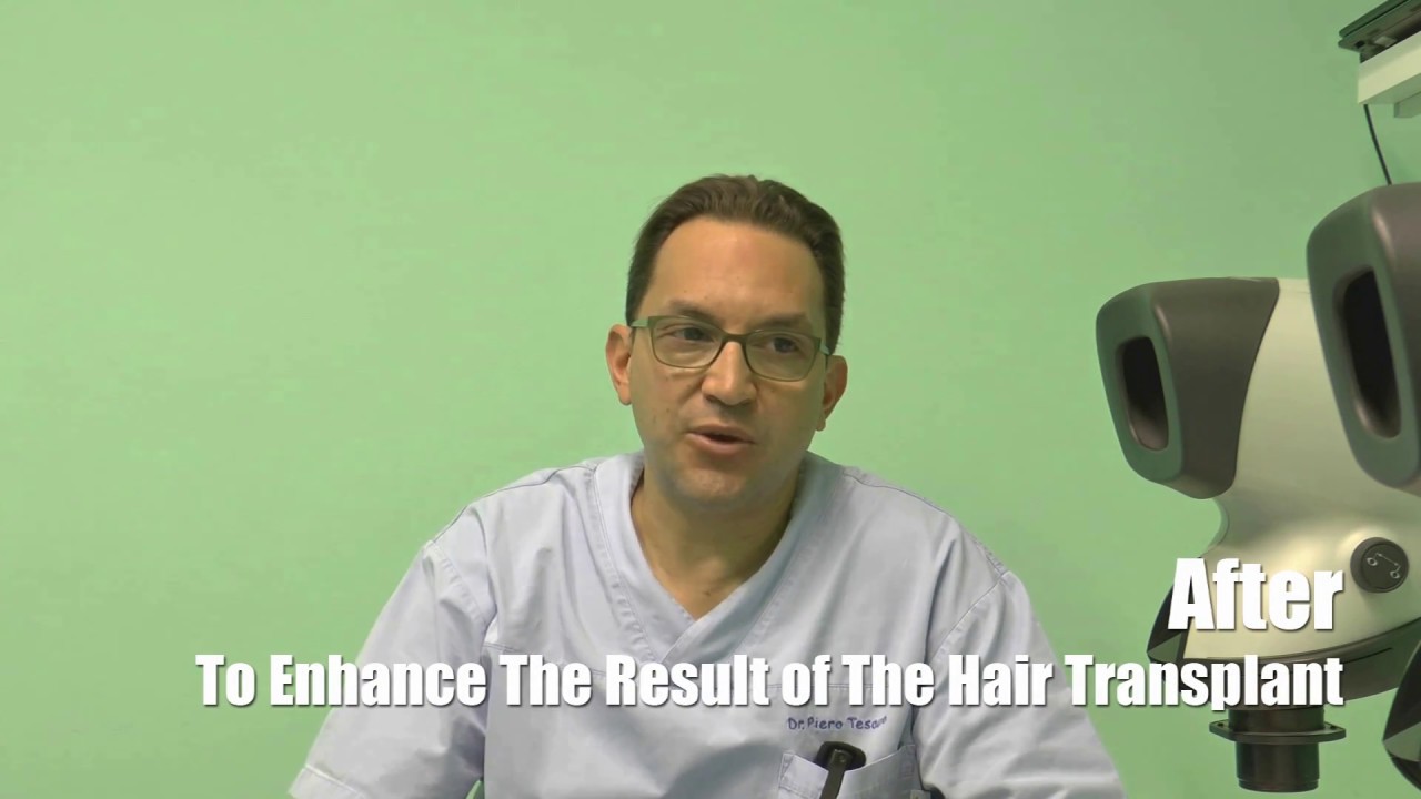 Piero Tesauro MD and SMP (tricopigmentation)
