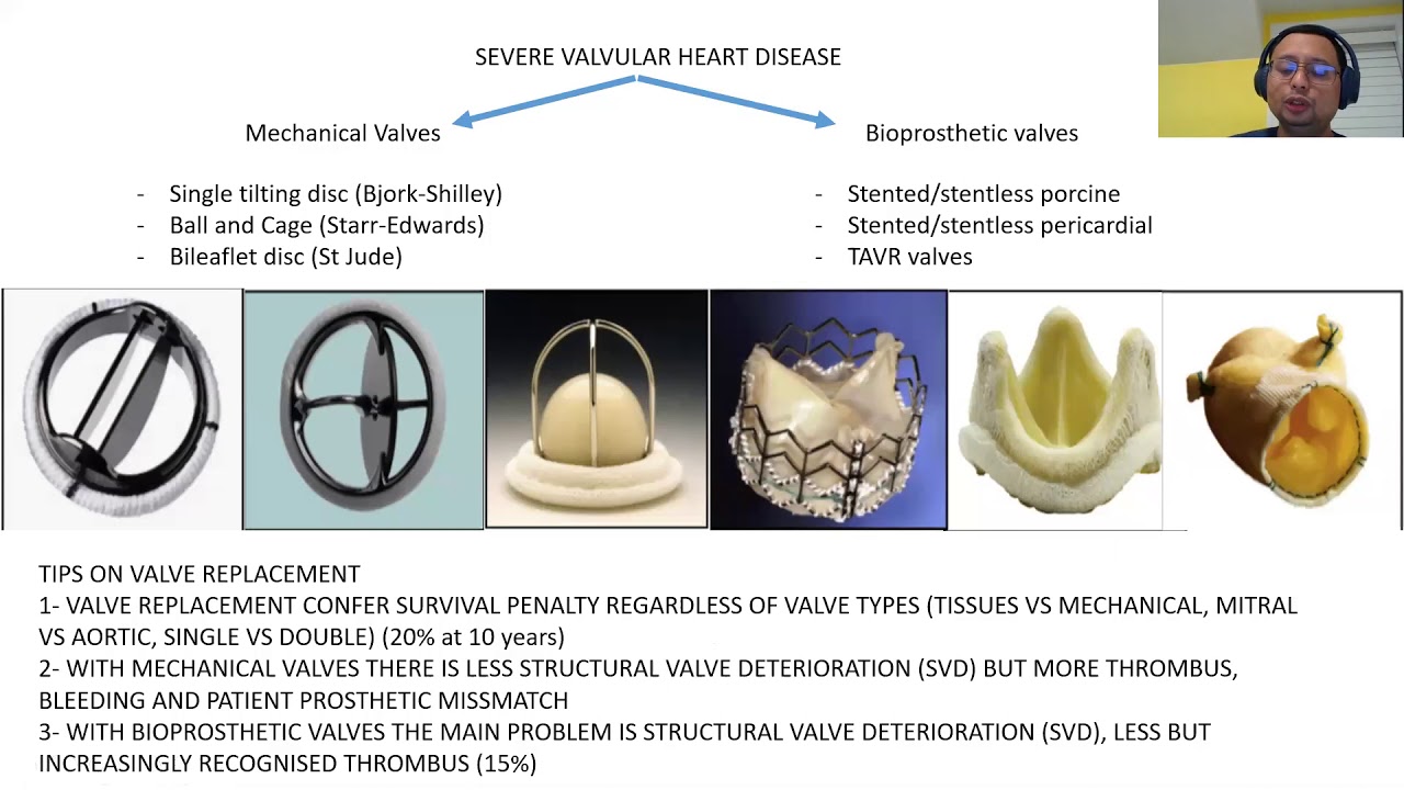 Prosthetic aortic valve dysfunction