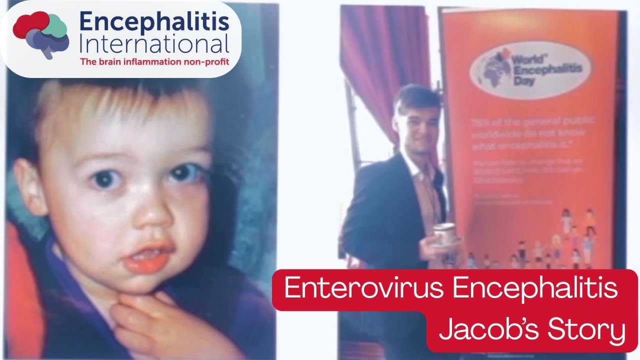 Jacob and Liz: Enterovirus Encephalitis Lived Experience #ViralEncephalitis #Encephalitis