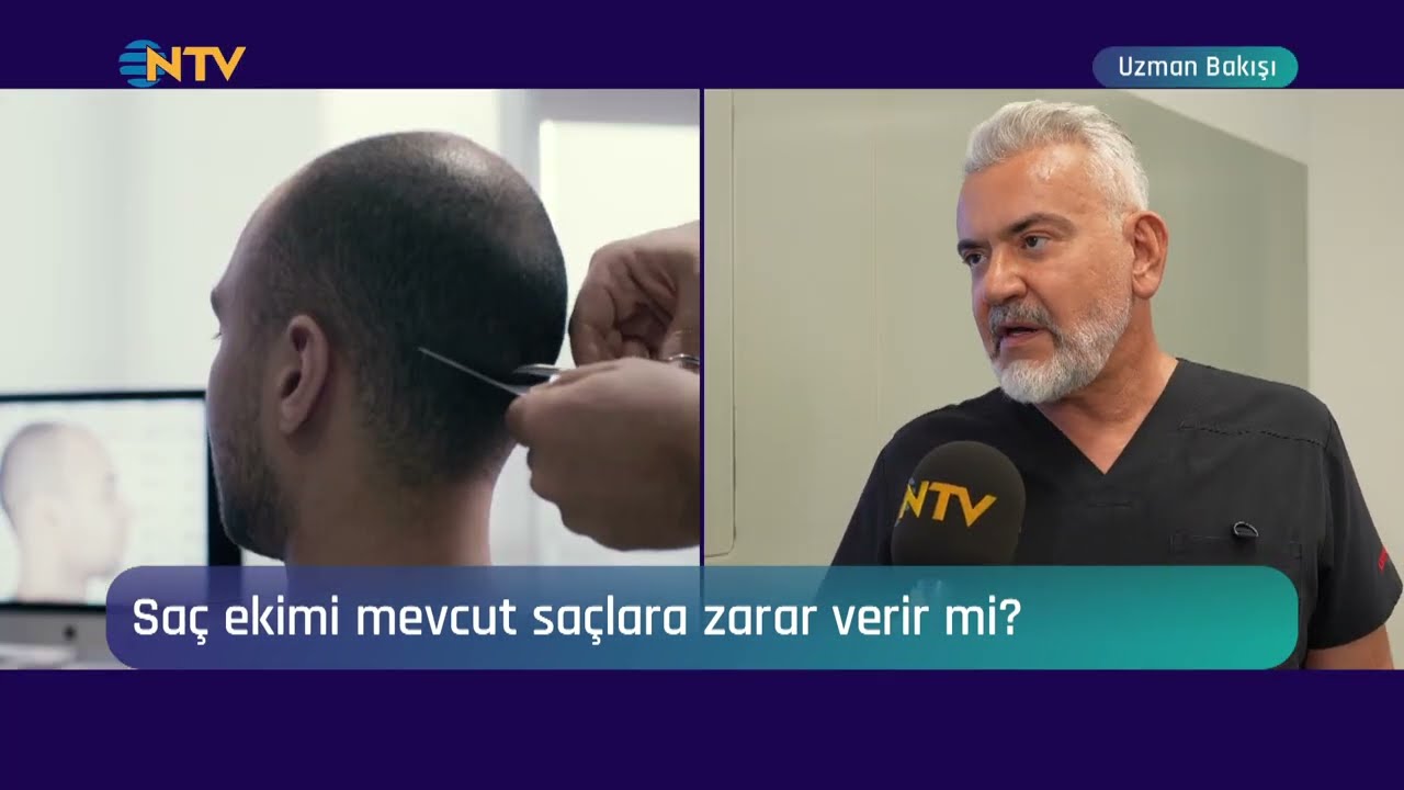 Saç Ekimi Mevcut Saçlara Zarar Verir Mi? Dr. Koray Erdoğan NTV Uzman Bakışı  #asmed #korayerdogan