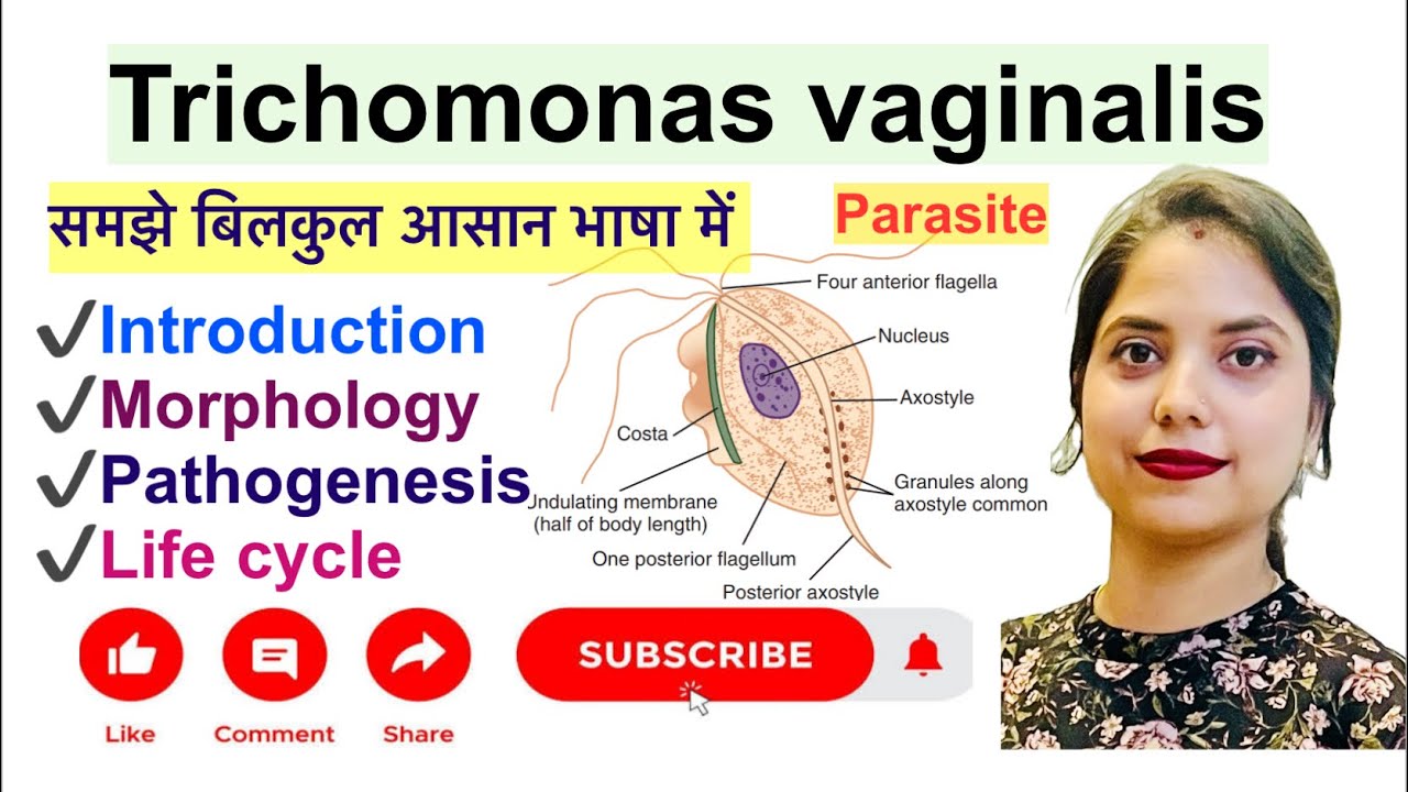 Trichomonas vaginalis in Hindi | Life cycle | Pathogenesis | समझे बिलकुल आसान भाषा में |