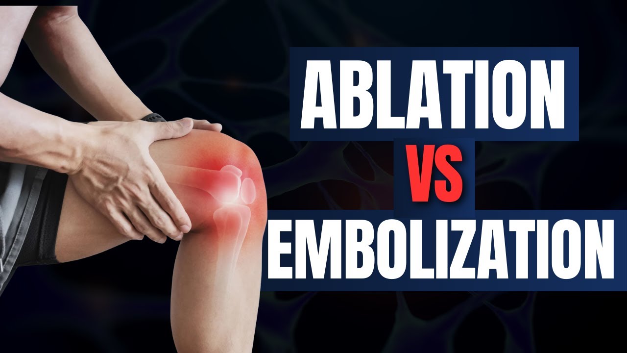 Genicular Artery Embolization vs Nerve Ablation | Which Works Better?