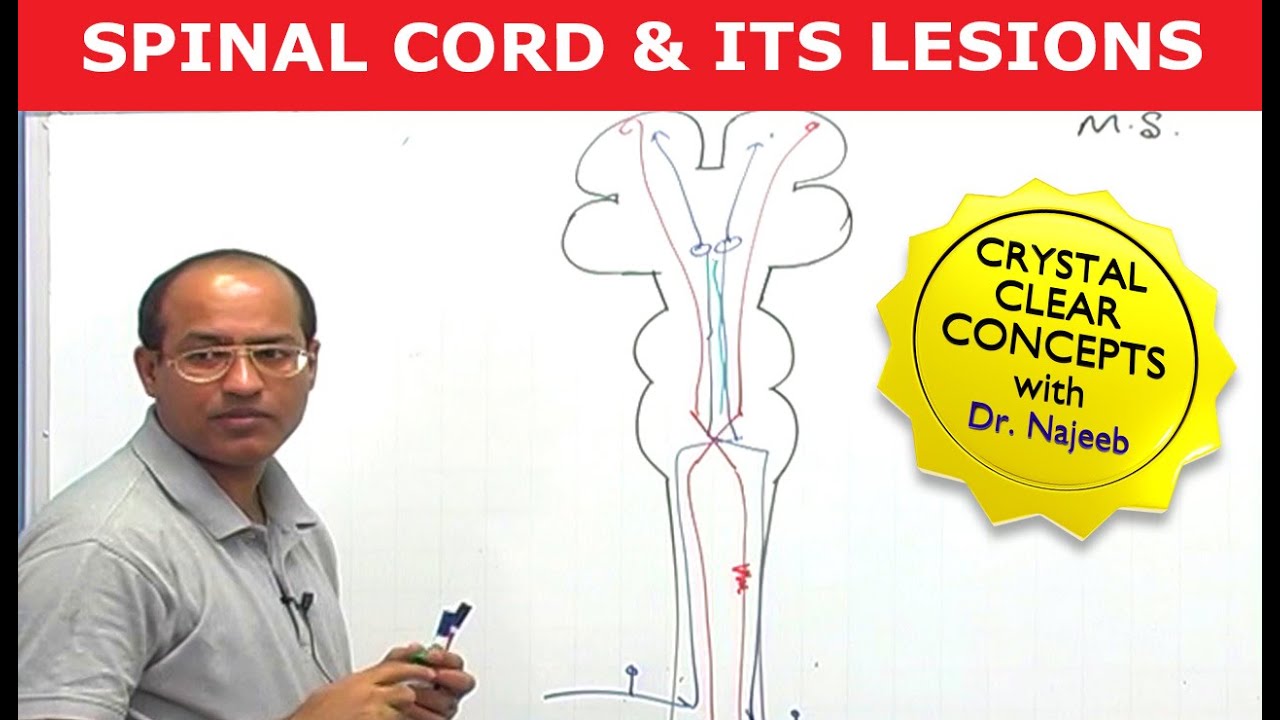 Spinal Cord Injury and its Lesions | Neuroanatomy