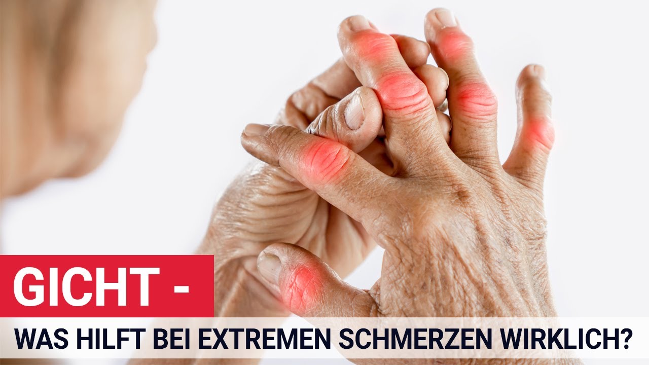 Gicht - Lebenslang unheilbare Schmerzen?