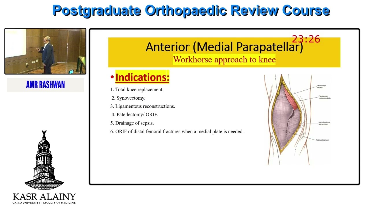 11  Knee Approaches   Amr Rashwan