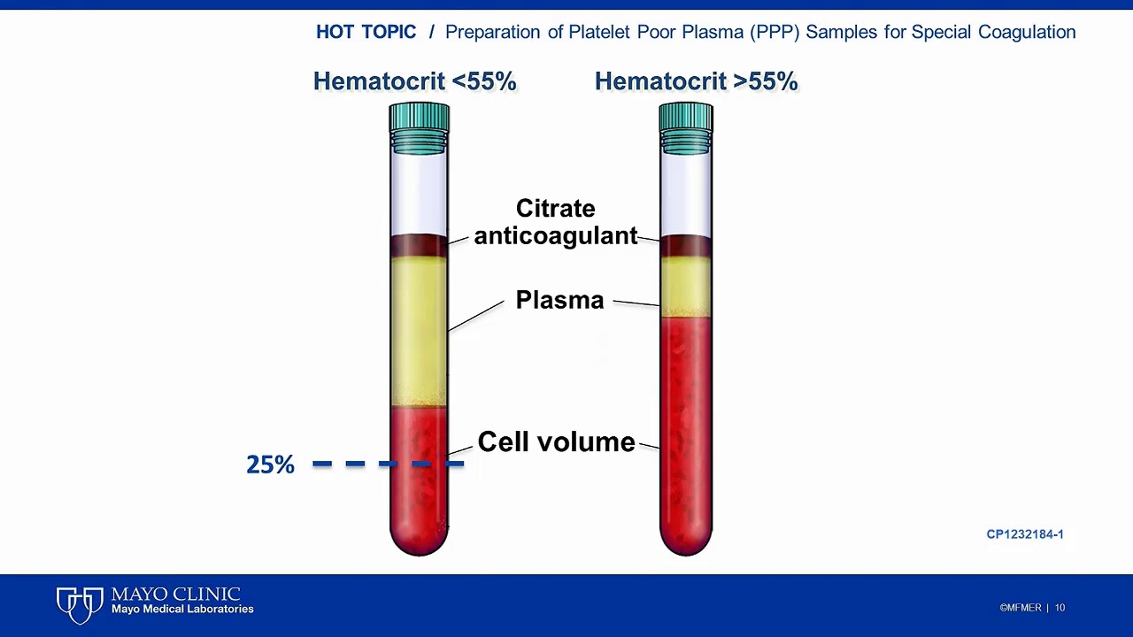 Platelet Poor Plasma Update [Hot Topic]
