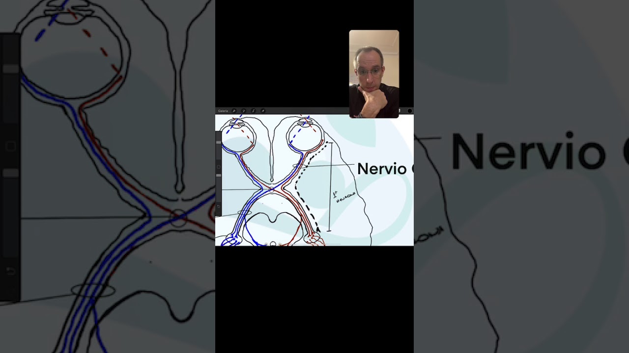Nervio Óptico NC II
