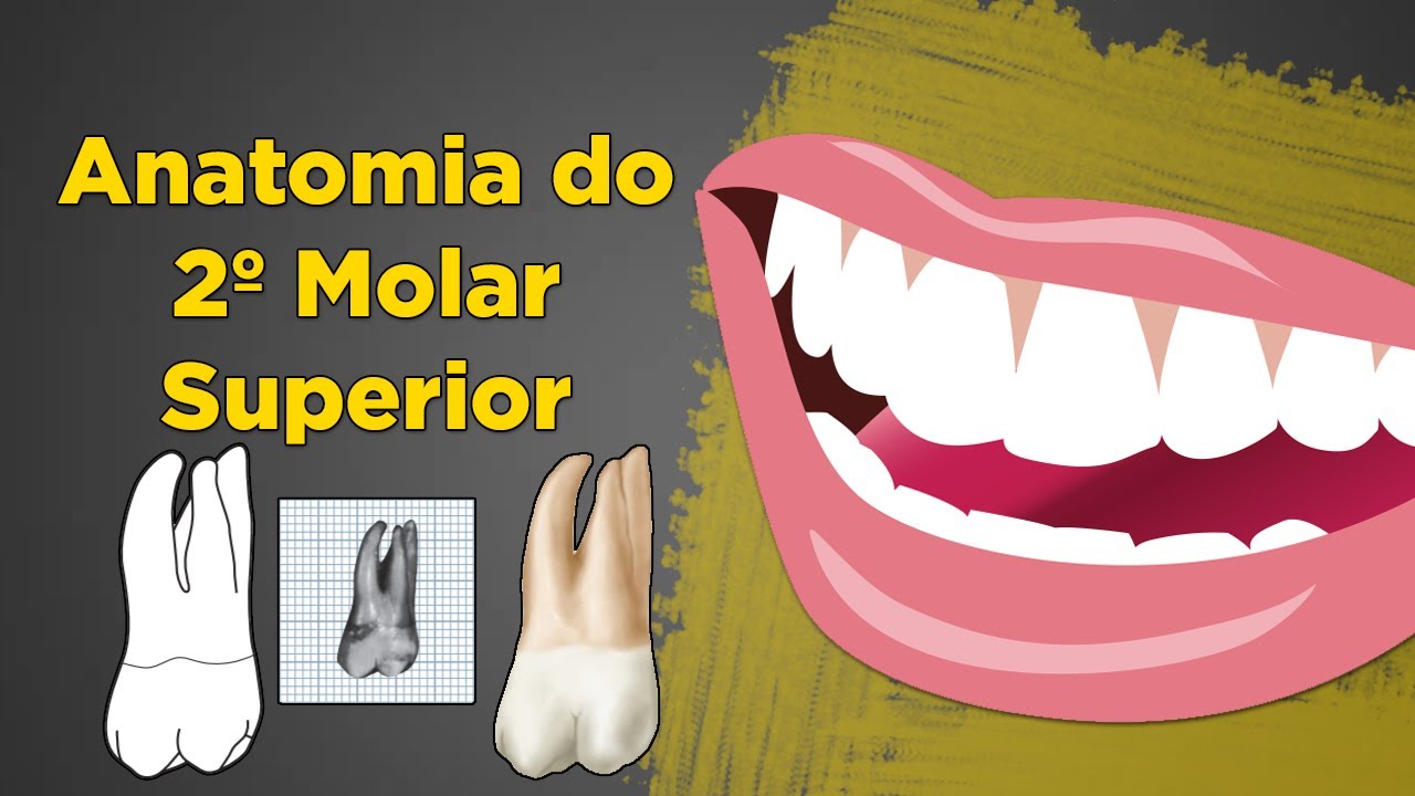 Segundo Molar Superior Anatomia - Resumo de Anatomia Dental - Dente 17 e 27