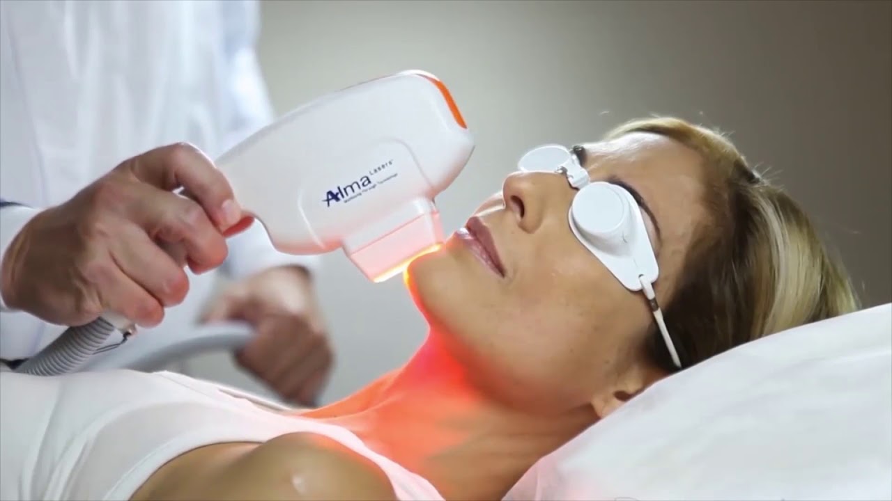 ALMA LASERS - QUIENES SOMOS