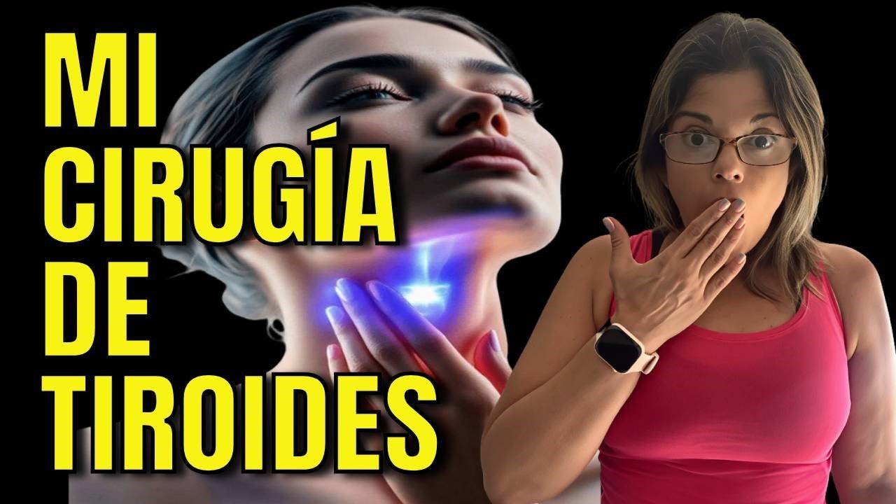 LO QUE NADIE TE CUENTA DE UNA OPERACIÓN DE TIROIDES