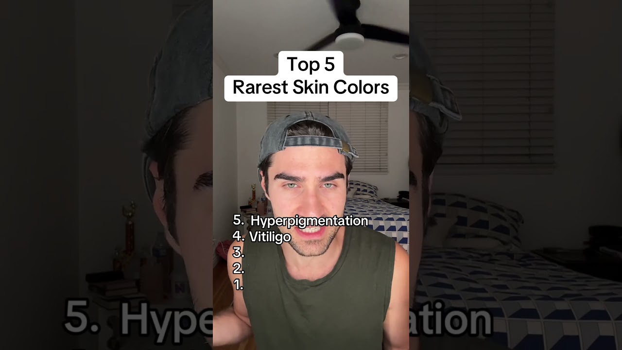 Top 5 Rarest Skin Colors