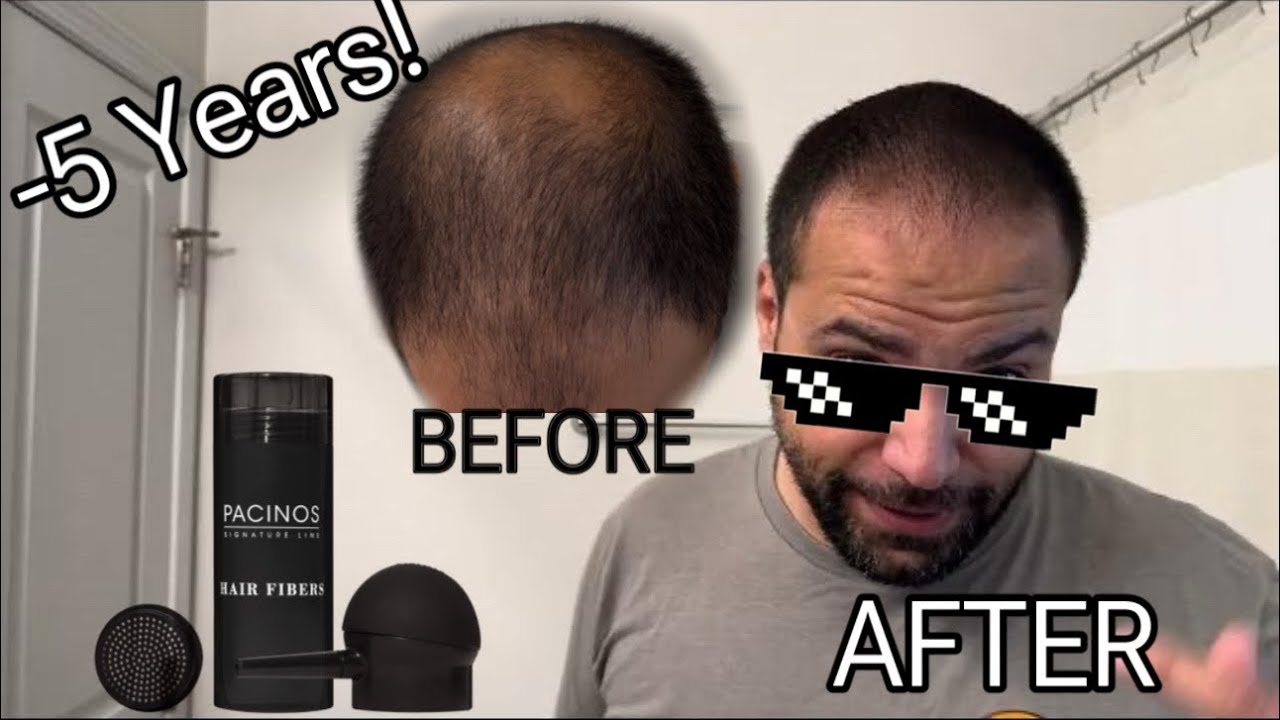 NO MORE BALDBESS!!! PACINOS HAIR FIBERS FILLER, LOOK YOUNGER IN 3 TO 5 MINUTES!!!