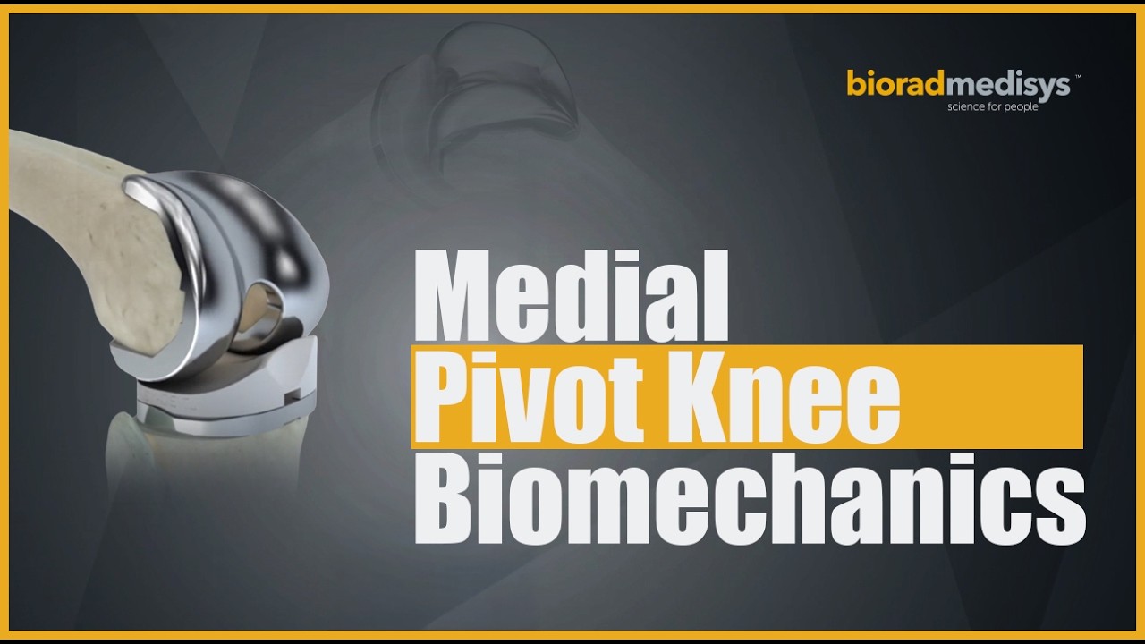 Excel Medial Pivot Knee | Complete Product Overview by Biorad Medisys