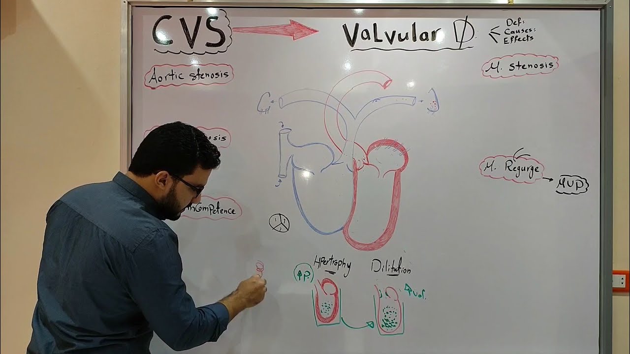 CVS Module - Valvular diseases