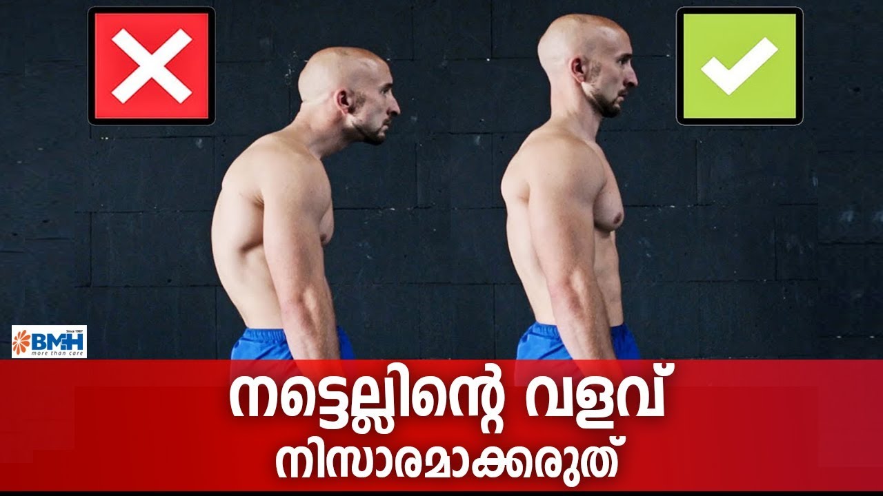 നിങ്ങളുടെ നട്ടെല്ല് വളഞ്ഞതാണോ? എങ്ങനെ തിരിച്ചറിയാം | Scoliosis Treatment in Malayalam