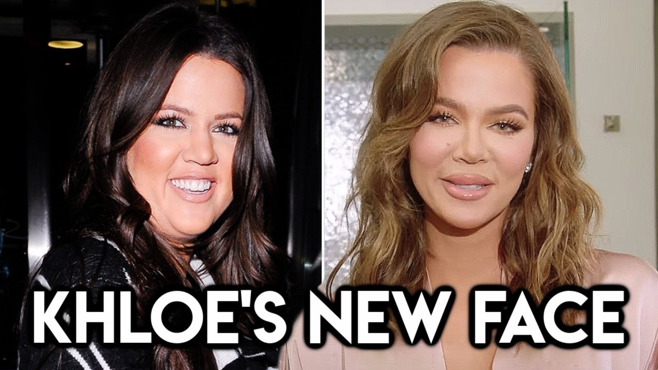 KHLOE KARDASHIAN’S NEW FACE #ChiomaChats
