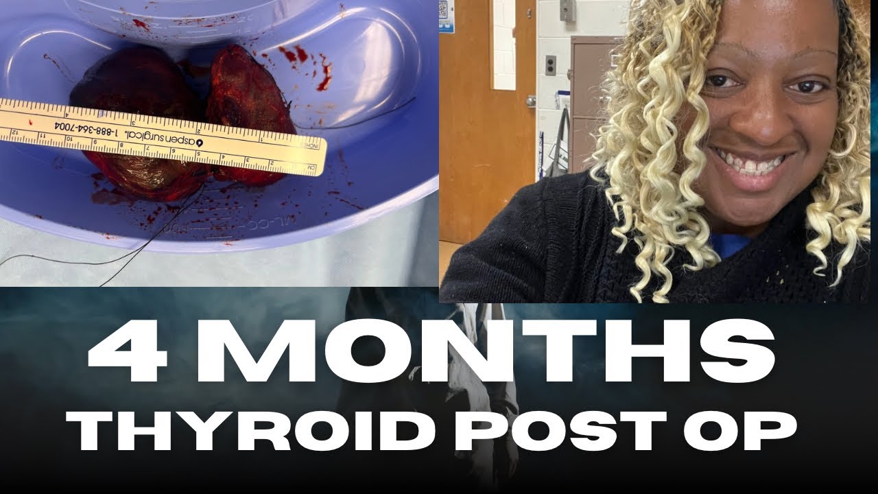 THYROID SURGERY POST OP MONTH 4