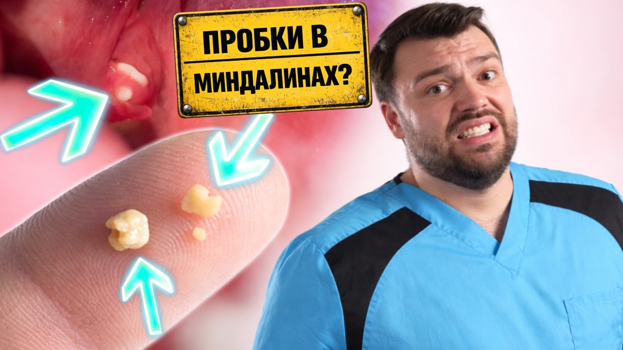 Пробки в миндалинах → сердце и суставы: скрытая связь
