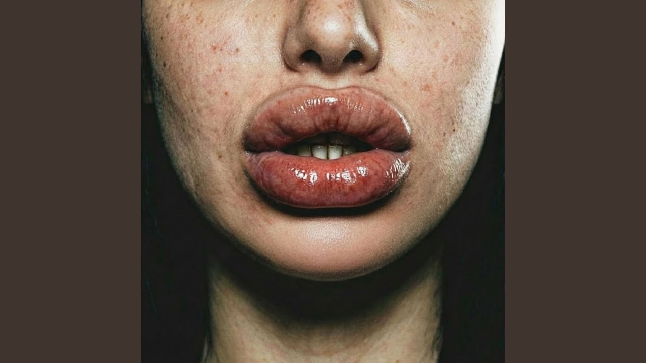 FILLER