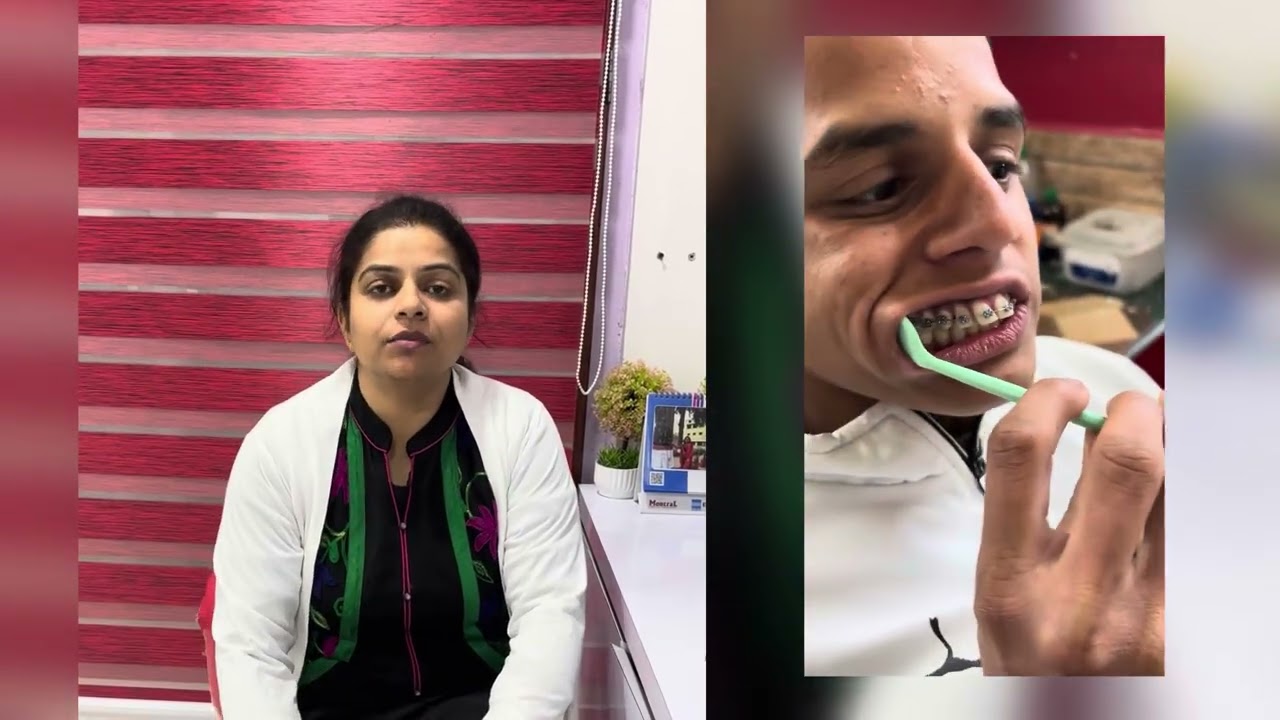 ब्रेसेज़ के दौरान किन बातों का ध्यान रखें ⚠️# how to take care of your braces# wat to do and don't