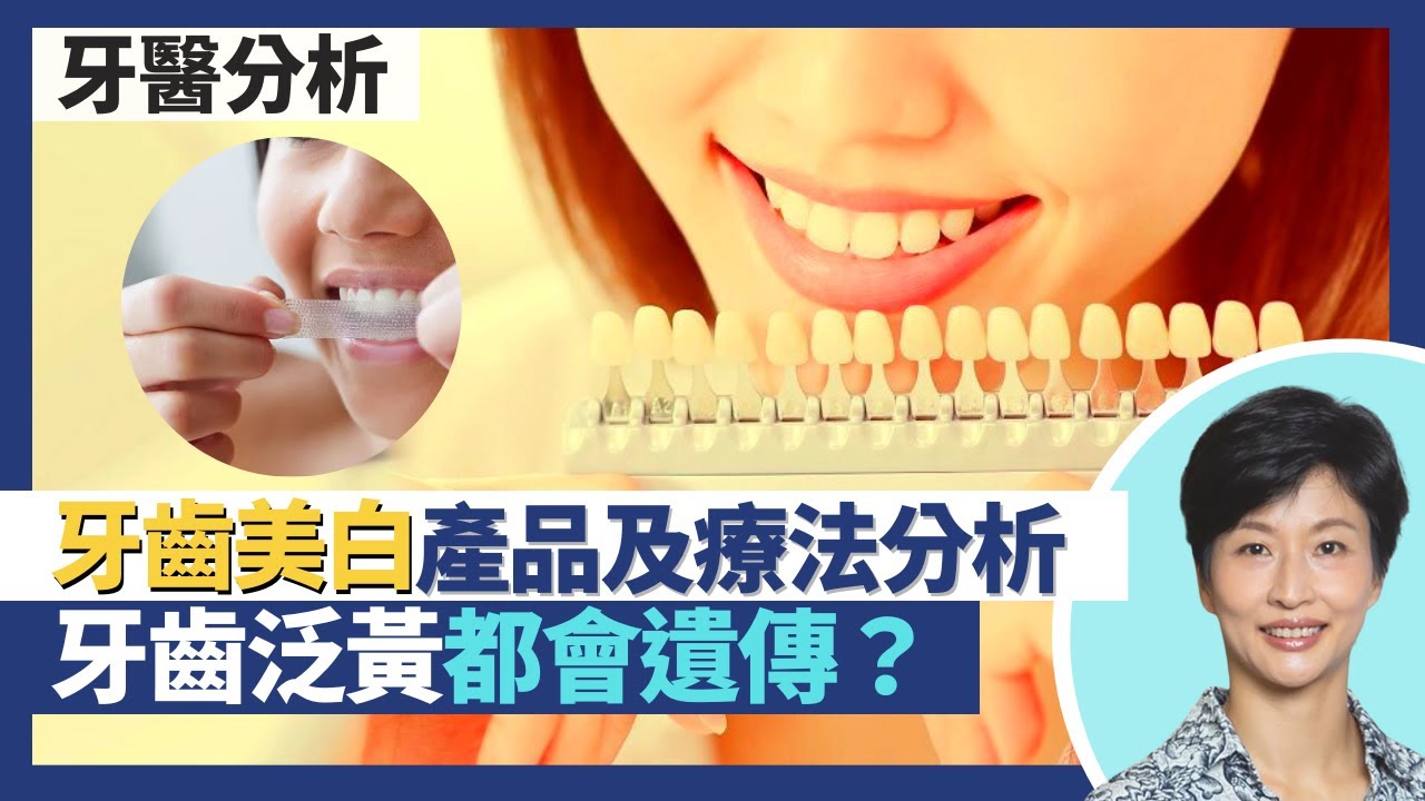 牙齒美白｜牙醫分析美白牙齒產品及療法 見到一種成份切勿用！牙齒變黃原因分析 牙黃都有遺傳？美白牙膏隨時刷走琺瑯質不應長期用｜王建芳醫生 牙科醫生李錦賓醫生｜人類健康研究所