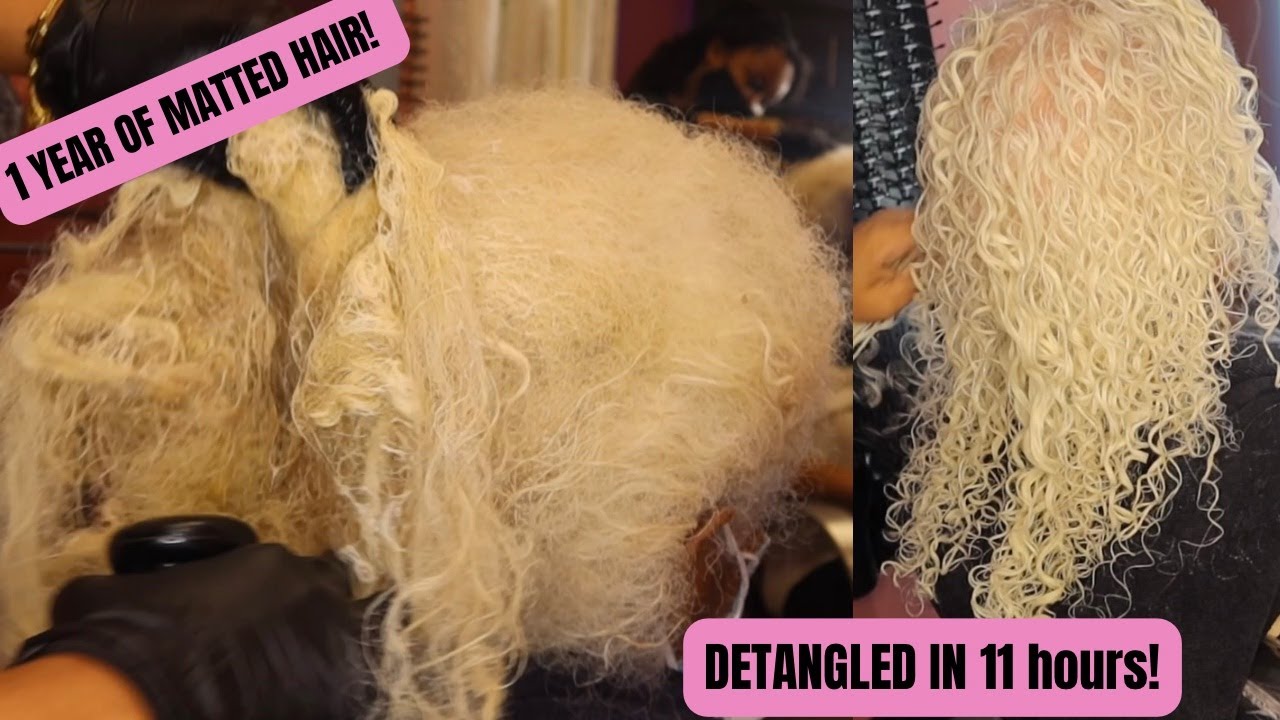 Detangle Matted Hair In 11 Hours With This One Product! | 1 Year of Matted Hair
