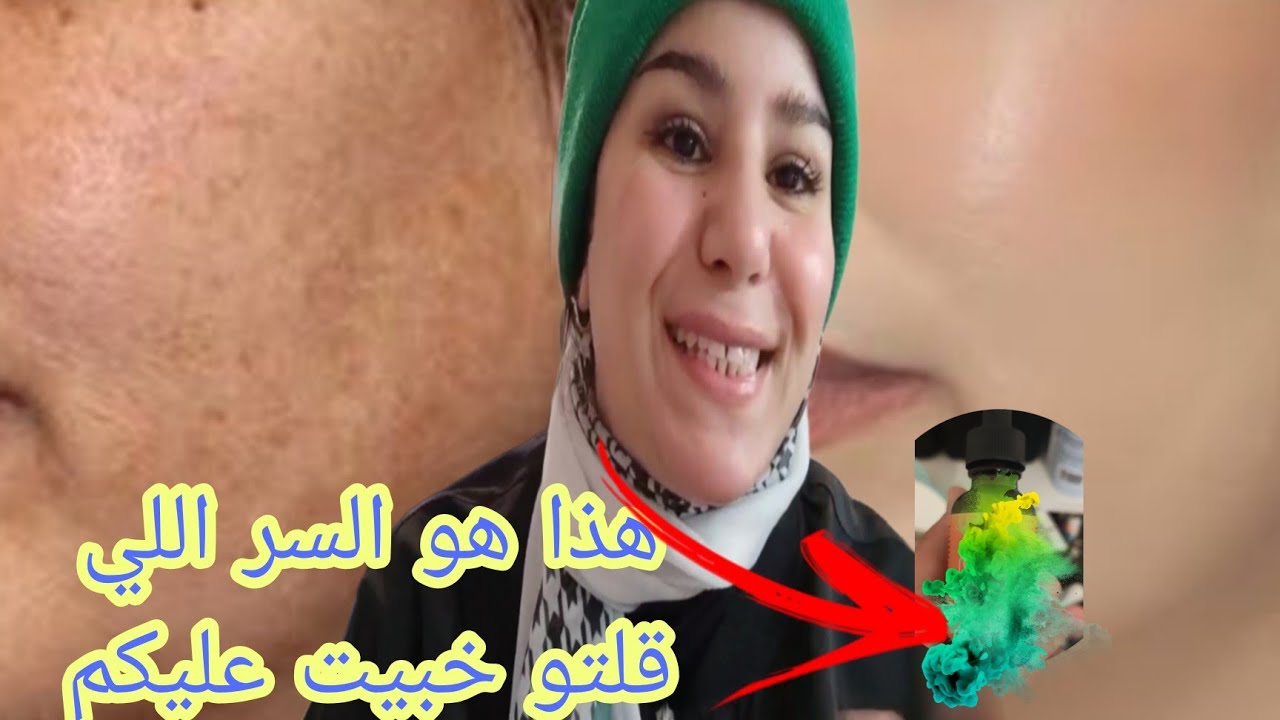 و أخيرا السر اللي خلا وجهي يشعل و هناني من الكلف🤩وجهي ولا بيض من باقي جسمي🌿هذا هو سري و ربي شاهد علي