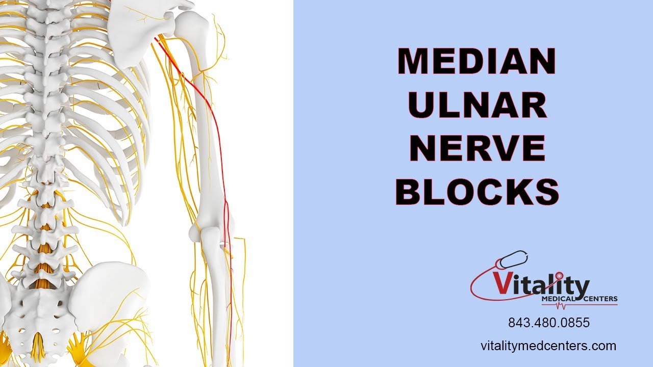Nerve Blocks to Treat Peripheral Neuropathy of the Arms, Hands and Fingers