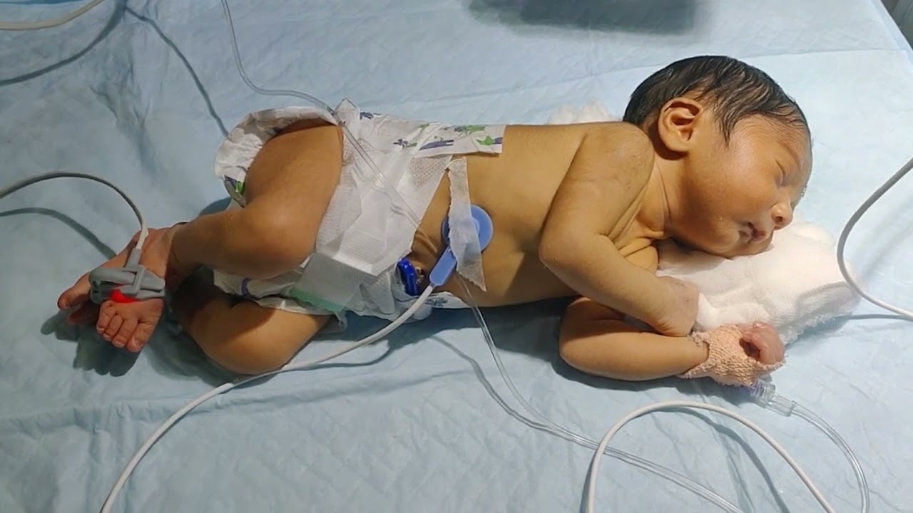 Qute baby sleeping in Nicu | babies | Sleep baby cry | Nicu baby care