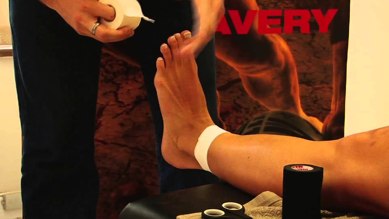 Protective Strapping (Medial deltoid instability)