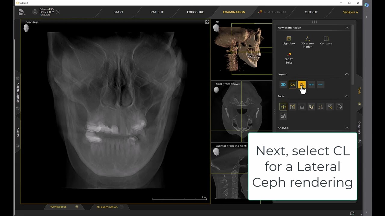 Imaging Training Session 26: Sidexis 4 – 3D Ceph Layouts