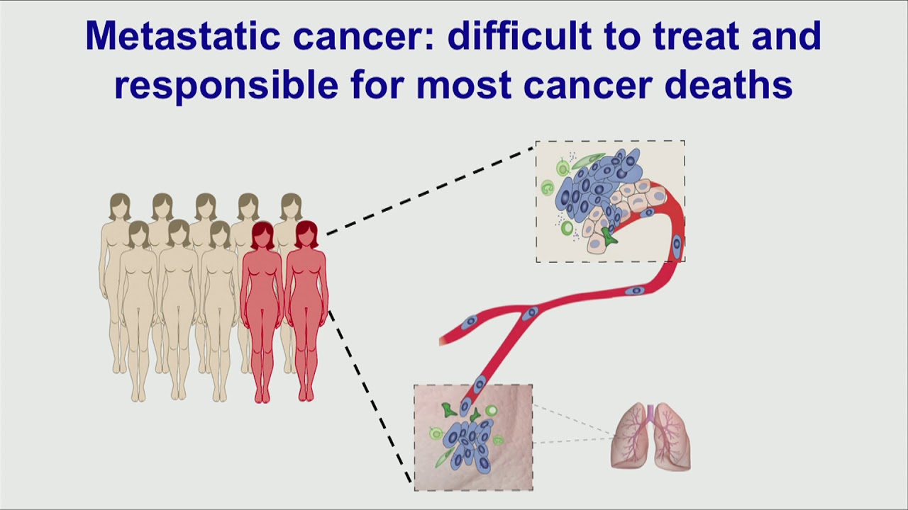 Public lecture: METASTASIS & IMMUNITY
