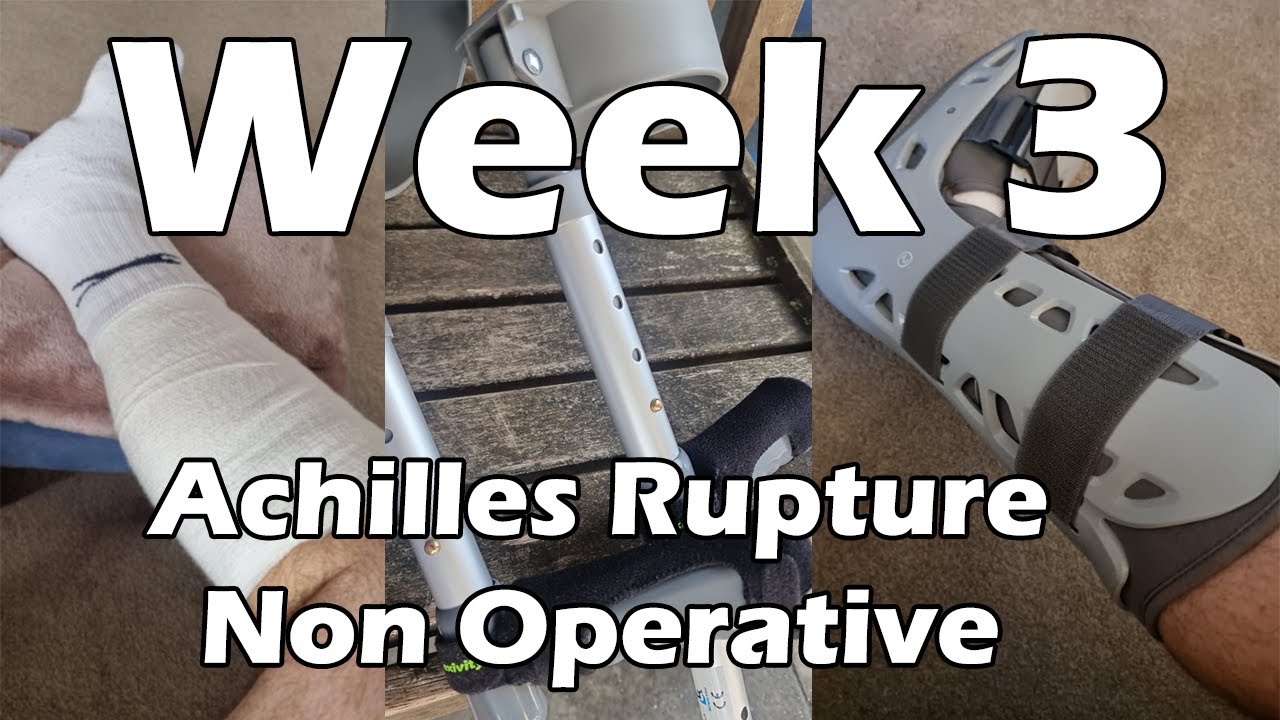 Achilles Rupture Recovery - Week 3 - Non Surgical