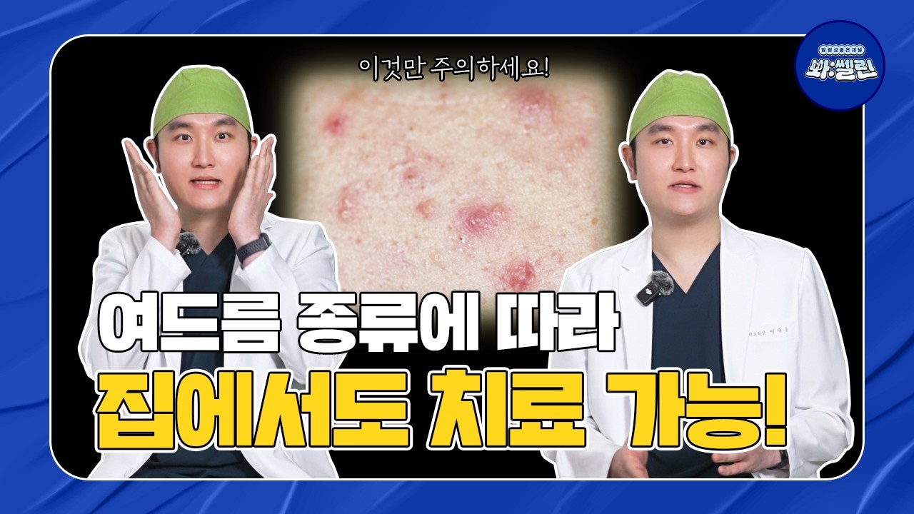 이런 여드름이 아닌 경우 집에서도 치료 가능합니다ㅣ 봐:쎌린