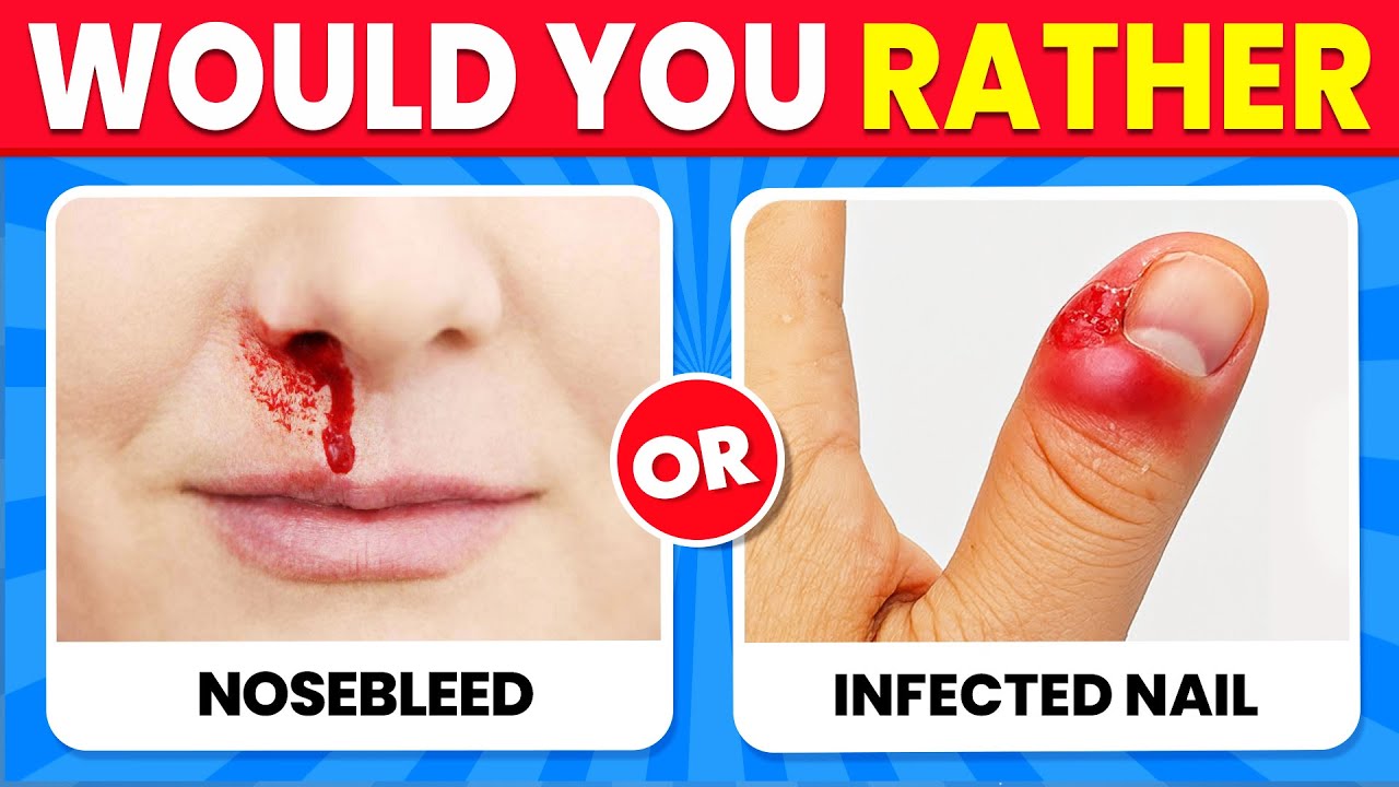 Что бы вы предпочли...? Самый сложный выбор!⚠️😱 Экстремальное издание! | The Quiz Nova