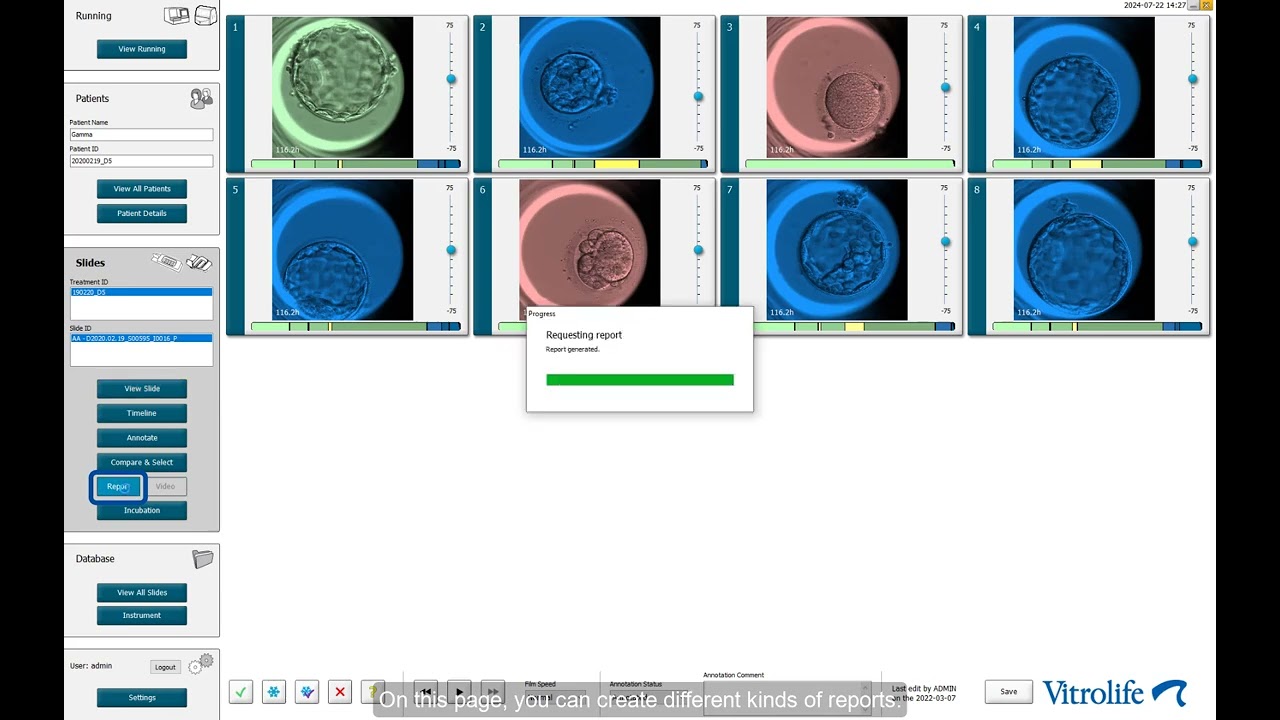 Tour around the EmbryoViewer Software 7.5