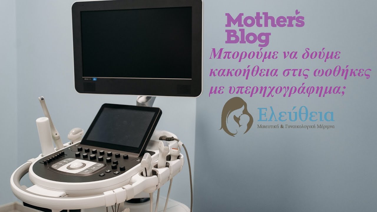 &Mu;&pi;&omicron;&rho;&omicron;ύ&mu;&epsilon; &nu;&alpha; &delta;&omicron;ύ&mu;&epsilon; &kappa;&alpha;&kappa;&omicron;ή&theta;&epsilon;&iota;&alpha; &sigma;&tau;&iota;&sigmaf; &omega;&omicron;&theta;ή&kappa;&epsilon;&sigmaf; &mu;&epsilon; &upsilon;&pi;&epsilon;&rho;&eta;&chi;&omicron;&gamma;&rho;ά&phi;&eta;&mu;&alpha;;
