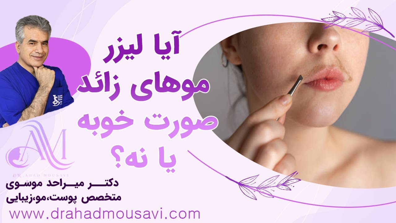 لیزر موهای زائد صورت خوبه؟ همه فواید، هزینه‌ها و عوارض واقعی که باید بدانید!