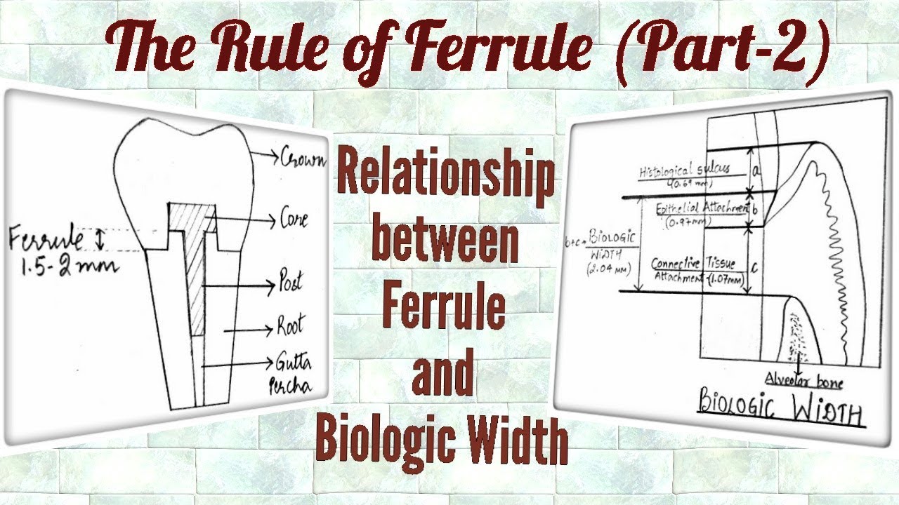 Ferrule Effect (Part-2)/ Relationship between Ferrule and Biologic Width