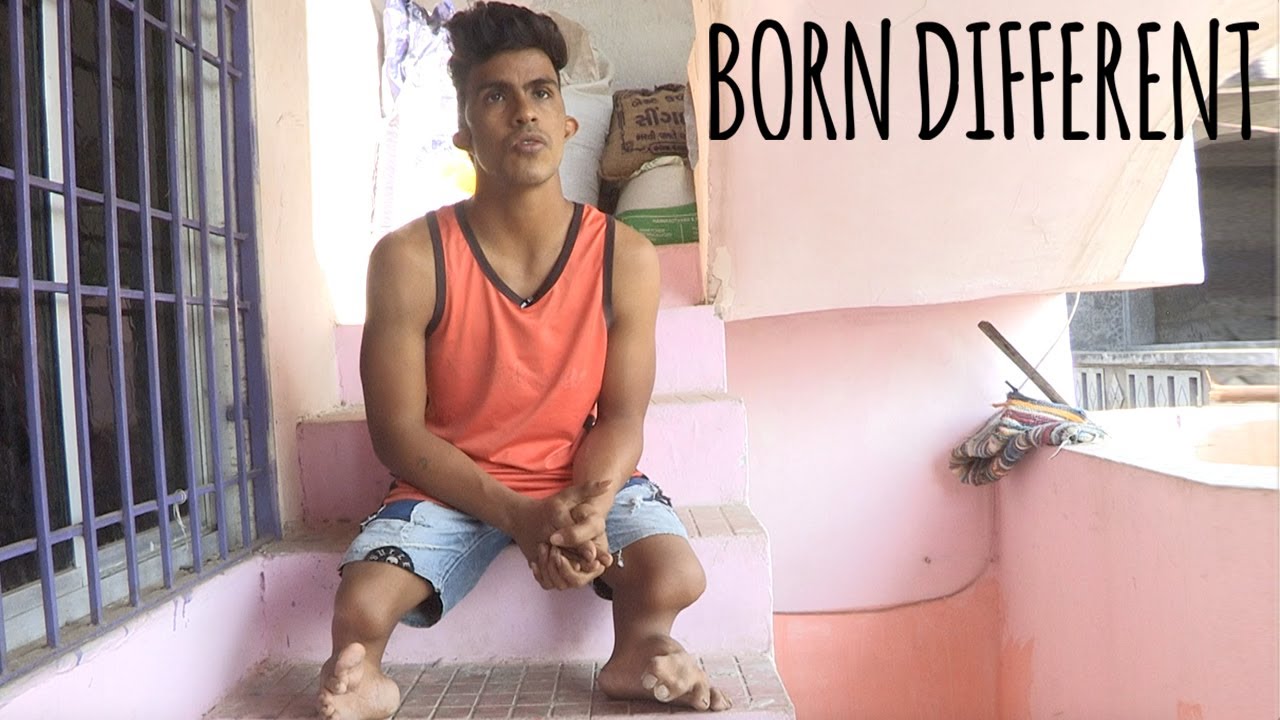 I'm Missing My Lower Legs - And No One Knows Why | BORN DIFFERENT