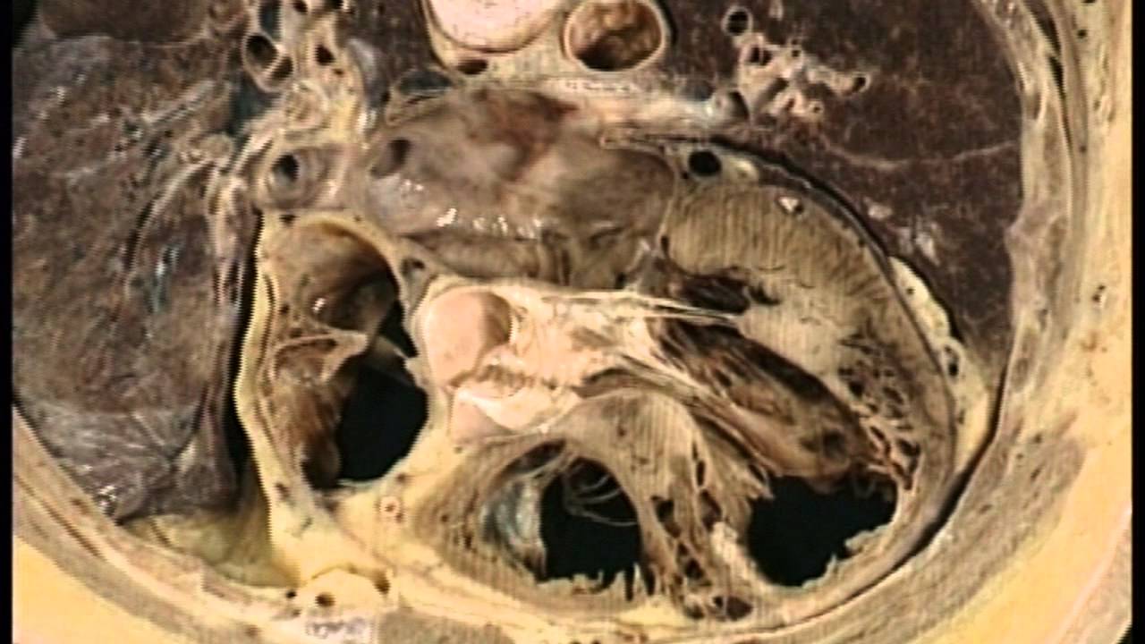 Anatom&iacute;a del coraz&oacute;n