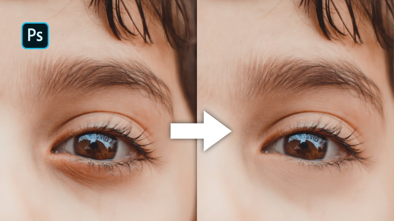 Como eliminar OJERAS ¡Fácil y Rápido! con ADOBE PHOTOSHOP | TUTORIAL
