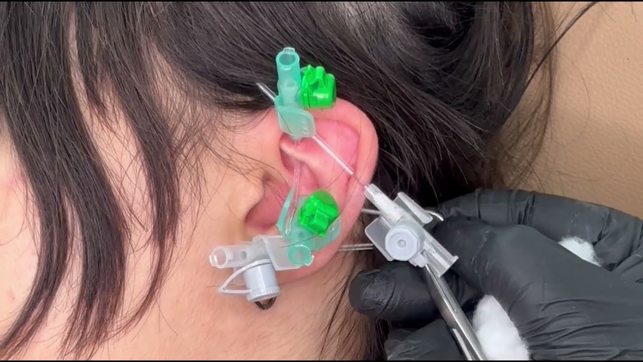 Industrial piercing / Rook piercing / Conch piercing / Inner lobe piercing