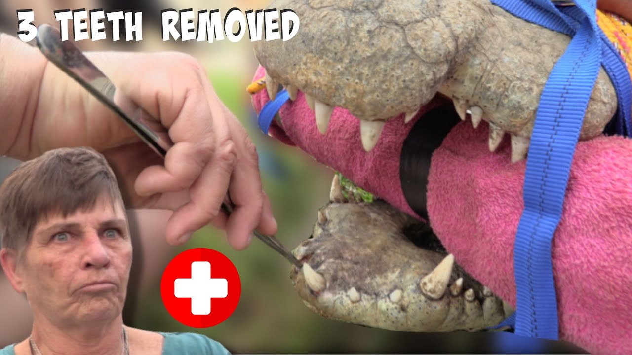 I Dared A Granny To Help Me Remove Three Teeth from Massive Crocodile!