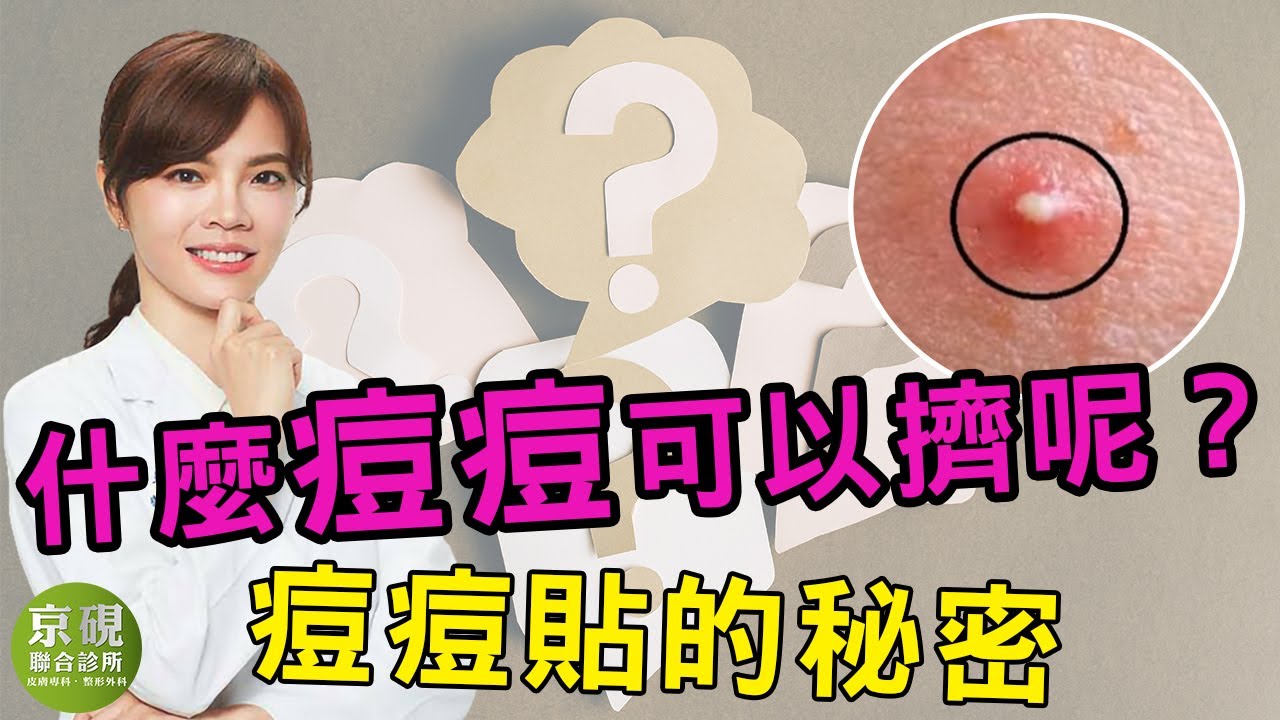 什麼痘痘可以擠?痘痘貼的秘密