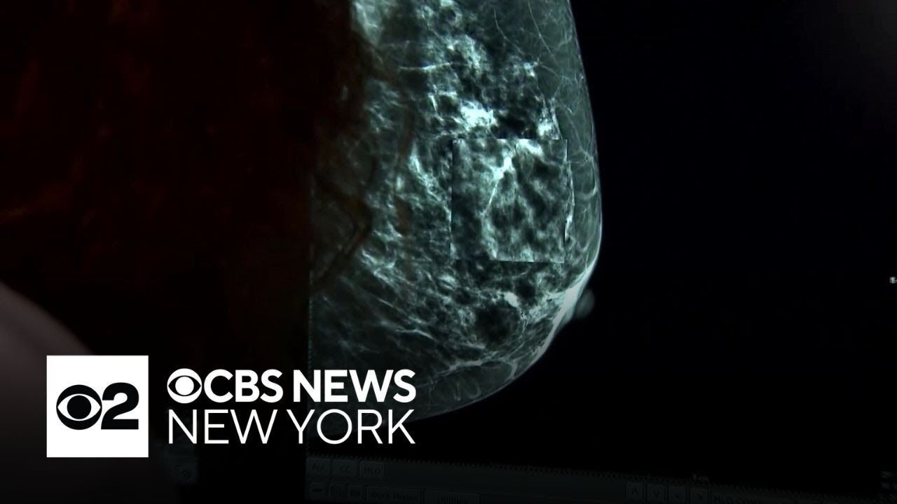 Discovery could revolutionize breast cancer treatment