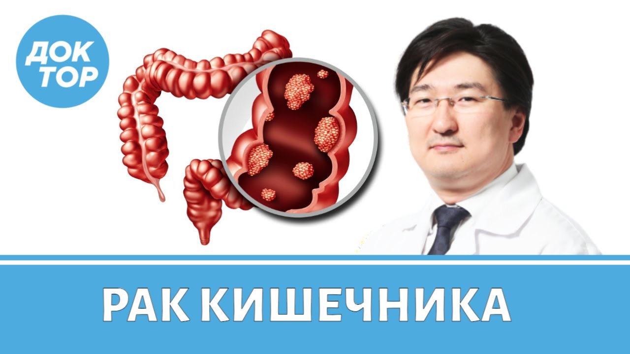 Хирург-онколог Бадма Башанкаев о раке кишечника