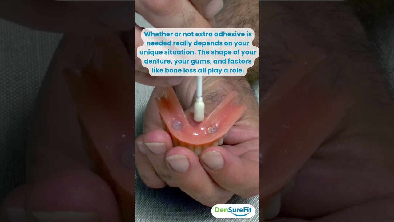 Does DenSureFit Work for Loose Lower Dentures